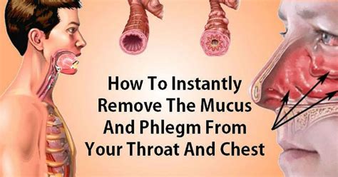 Phlegm is a different form of mucus made by the lower airways (throat and lungs) in response to inflammation. . Hard phlegm chunks from lungs